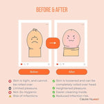 Phimorelief Kit – Phimosis Stretching Rings (20 Sizes) + Penile Heal Cream (30G) | Gentle And Safe, Gradual Stretching For Men