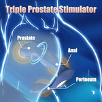 Anal Sex Toy Prostate Massager Vibrator with Remote Control, Adult Sex Toys and Games, Butterfly Vibrators for Perineum & Prostate Massage, Rotating & Vibrating Butt Dildo Anal Plug Male Prostate Toy