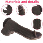 Realistic Huge Balck Dildo Sex Toys, 10.4" Sex Toy Feels Like Skin Big Thick Silicone Dildos For Clitoral Vagina G-Spot Anal Stimulation,Adult Penis Sex Toys For Women Men Couples (Coffee)