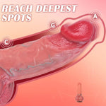 Realistic Huge Thick Dildo Sex Toys - 9.25'' Giant Thick Dildo With Lifelike Texture, G-Spot Anal Stimulation With Strong Suction Cup For Hands-Free Play, Adult Sex Toys & Games For Men Women