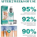 Anal Bleaching Aloe Gel,With Vitamin C And Aloe,- Upgraded Formula, 30Ml