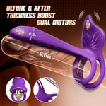 Vibrating Cock Ring Couples Sex Toys - Dual Penis Ring Vibrator With Fox-Shaped Clitoral Stimulator & 4.6In G Spot Vibrator, 10 Vibration Modes Adult Toys For Men Women, Female Male Sex Toy